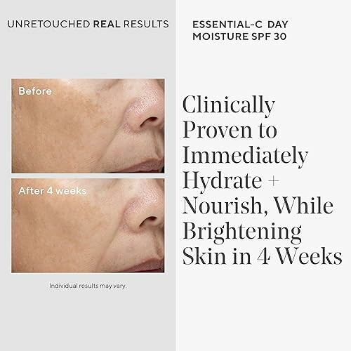 Before and after images showing skin improvement with text about hydration and brightening in 4 weeks.