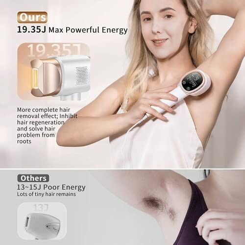 Comparison of hair removal devices, highlighting energy levels and effectiveness.