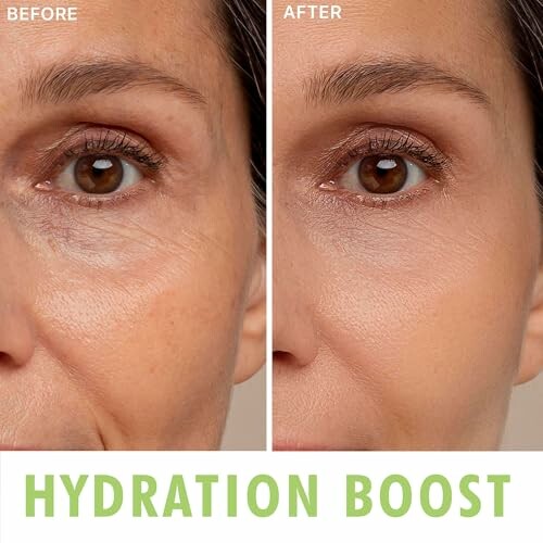 Comparison of skin before and after hydration treatment