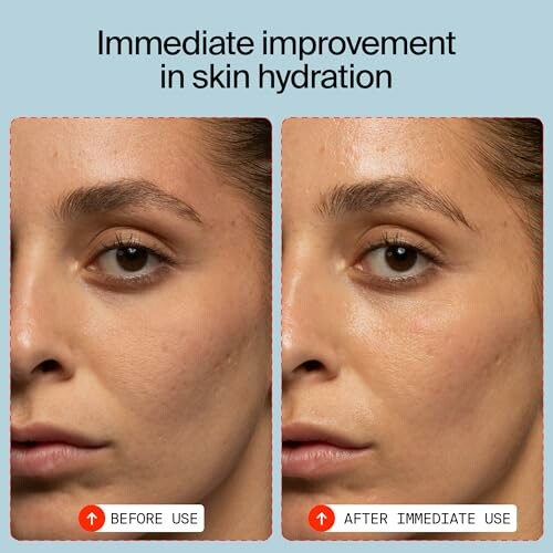 Comparison of skin hydration before and after use.